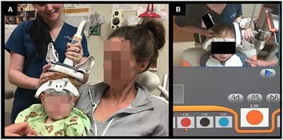 Clinical Utility of Transcranial Magnetic Stimulation (TMS) in the Presurgical Evaluation of Motor, Speech, and Language Functions in Young Children With Refractory Epilepsy or Brain Tumor: Preliminary Evidence